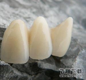 烤瓷牙的种类和价格