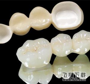烤瓷牙的种类和价格