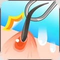 拔毛大师 V1.0 安卓版